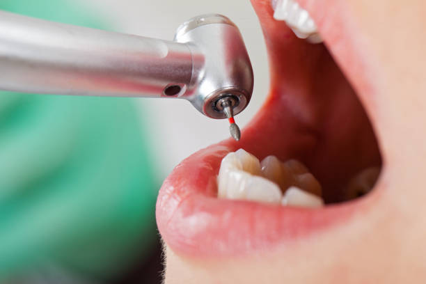 Best Pediatric Emergency Dentist in Lakemont, PA